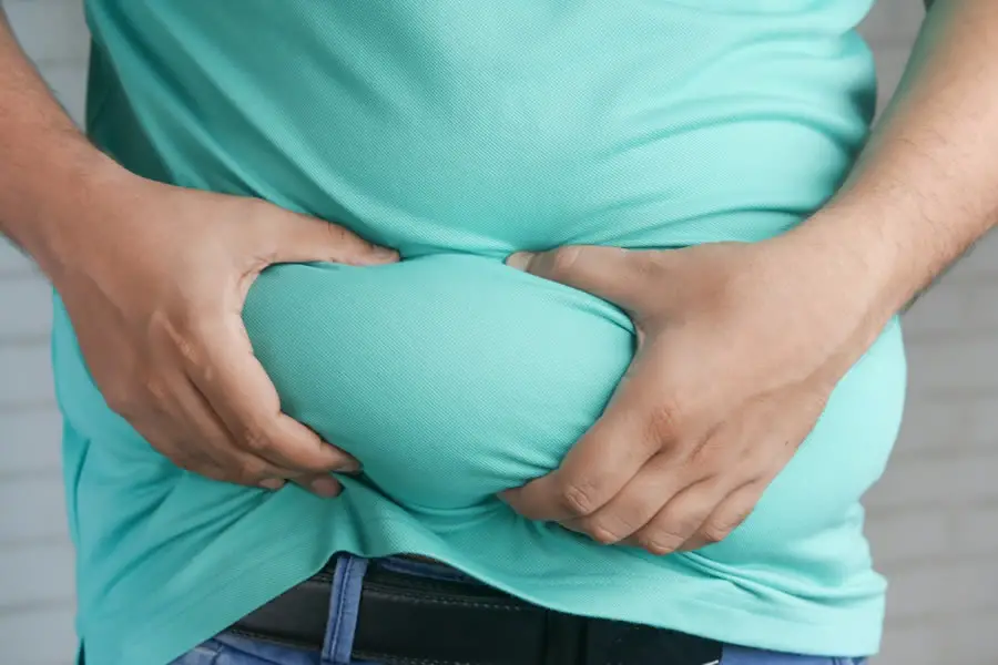 List of Obesity Vocabulary
